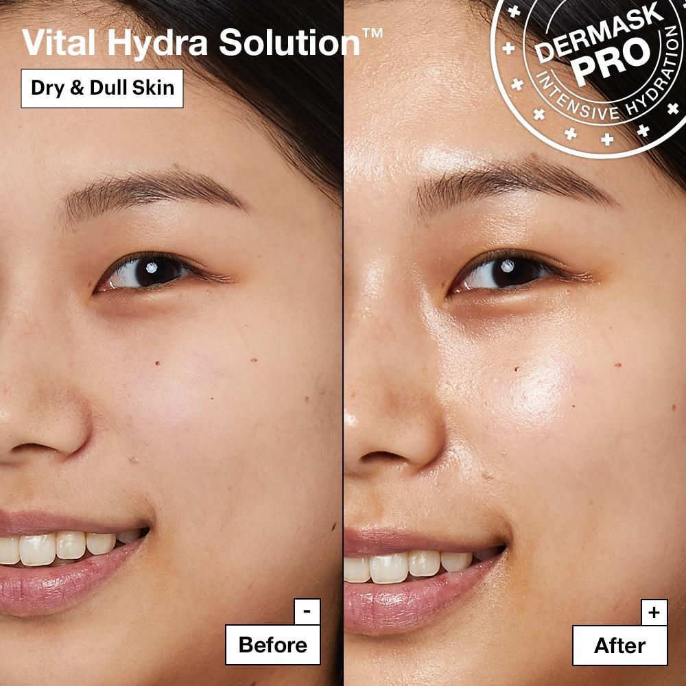 Dermask Water Jet Vital Hydra Solution x 5pc