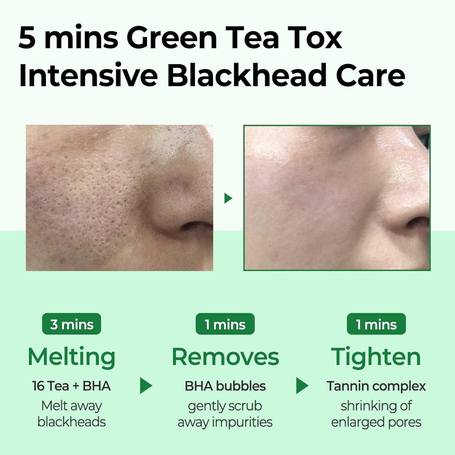BYE BYE BLACKHEAD 30 DAYS MIRACLE GREEN TEA TOX BUBBLE CLEANSER 120g