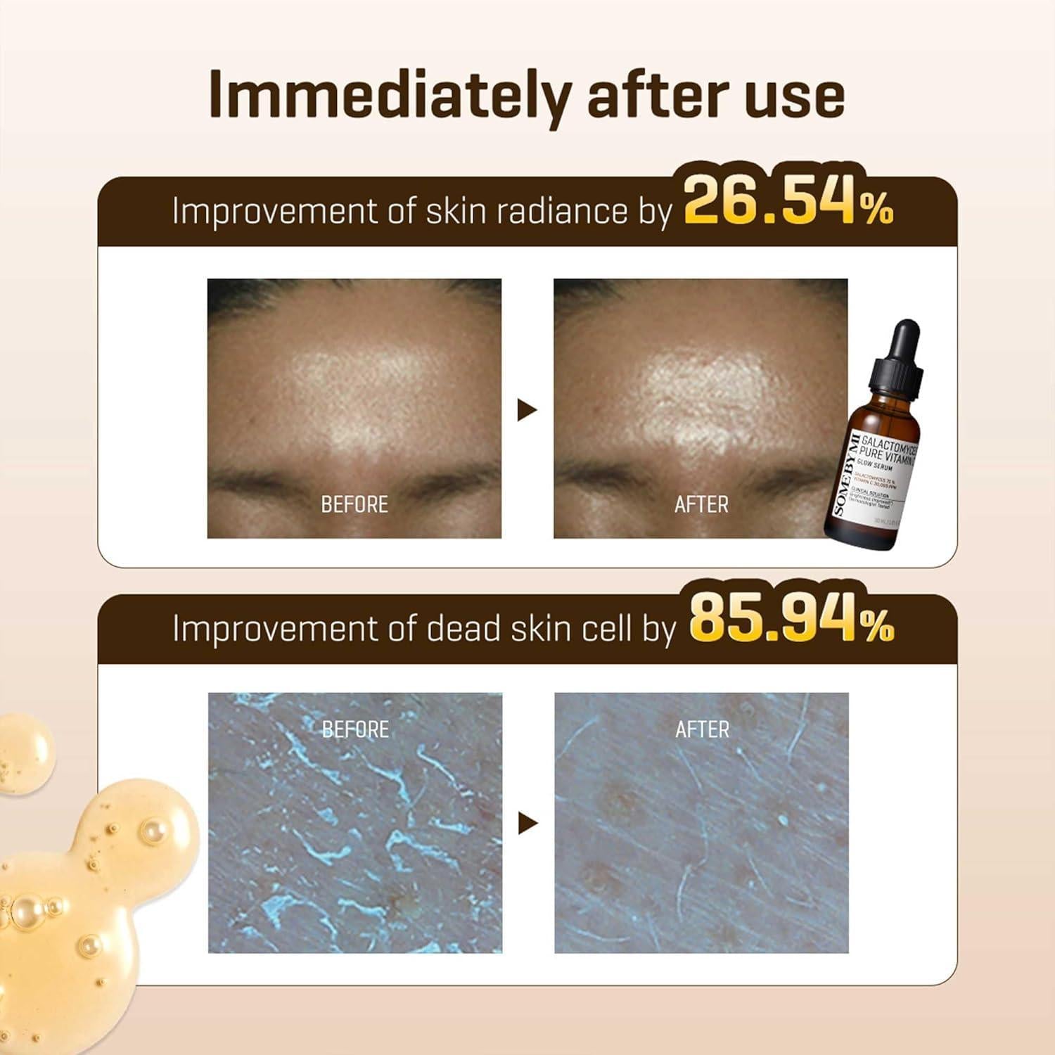 GALACTOMYCES PURE VITAMIN C GLOW SERUM 30ml