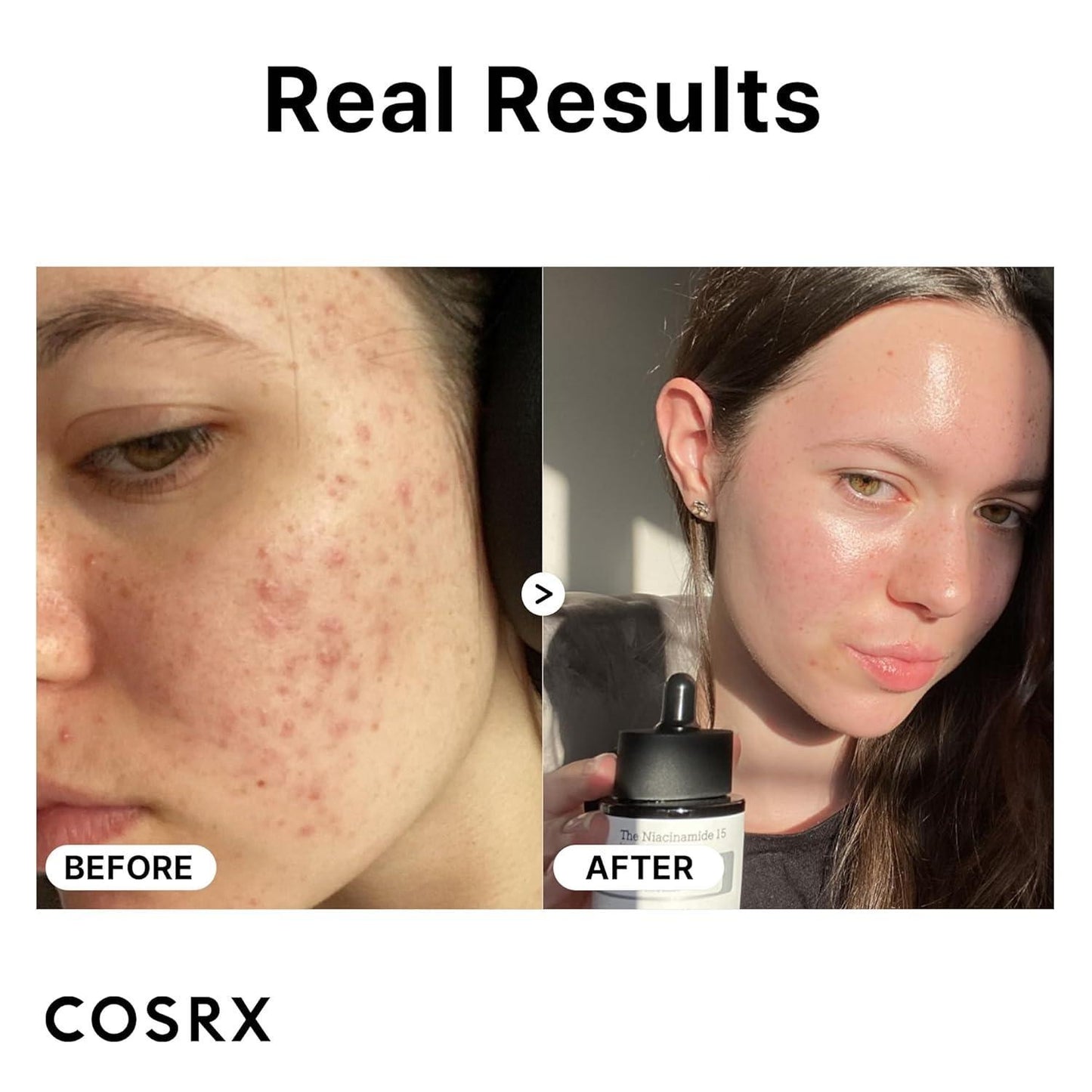The Niacinamide 15 Serum 20ml