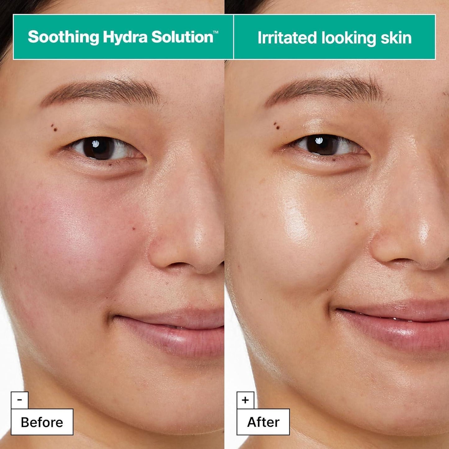 Dermask Soothing Hydra Solution Pro 1ea 25g