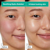 Dermask Soothing Hydra Solution Pro 1ea 25g