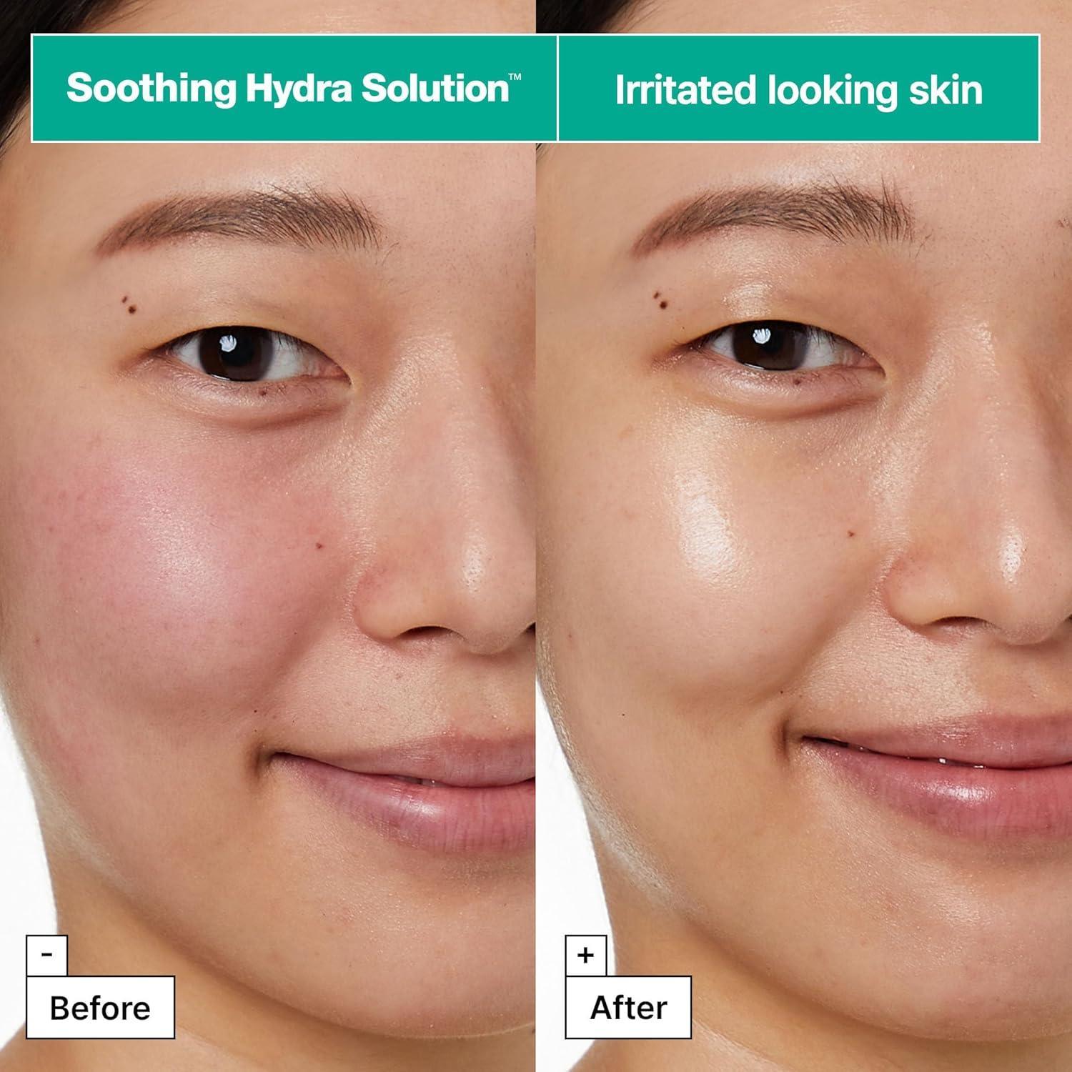 Dermask Soothing Hydra Solution Pro 1ea 25g