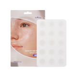 [Isntree] Onion Newpair Parches para imperfecciones Skin Fit 15 parches