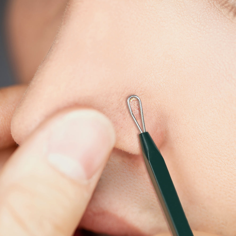 Pimple Extractor