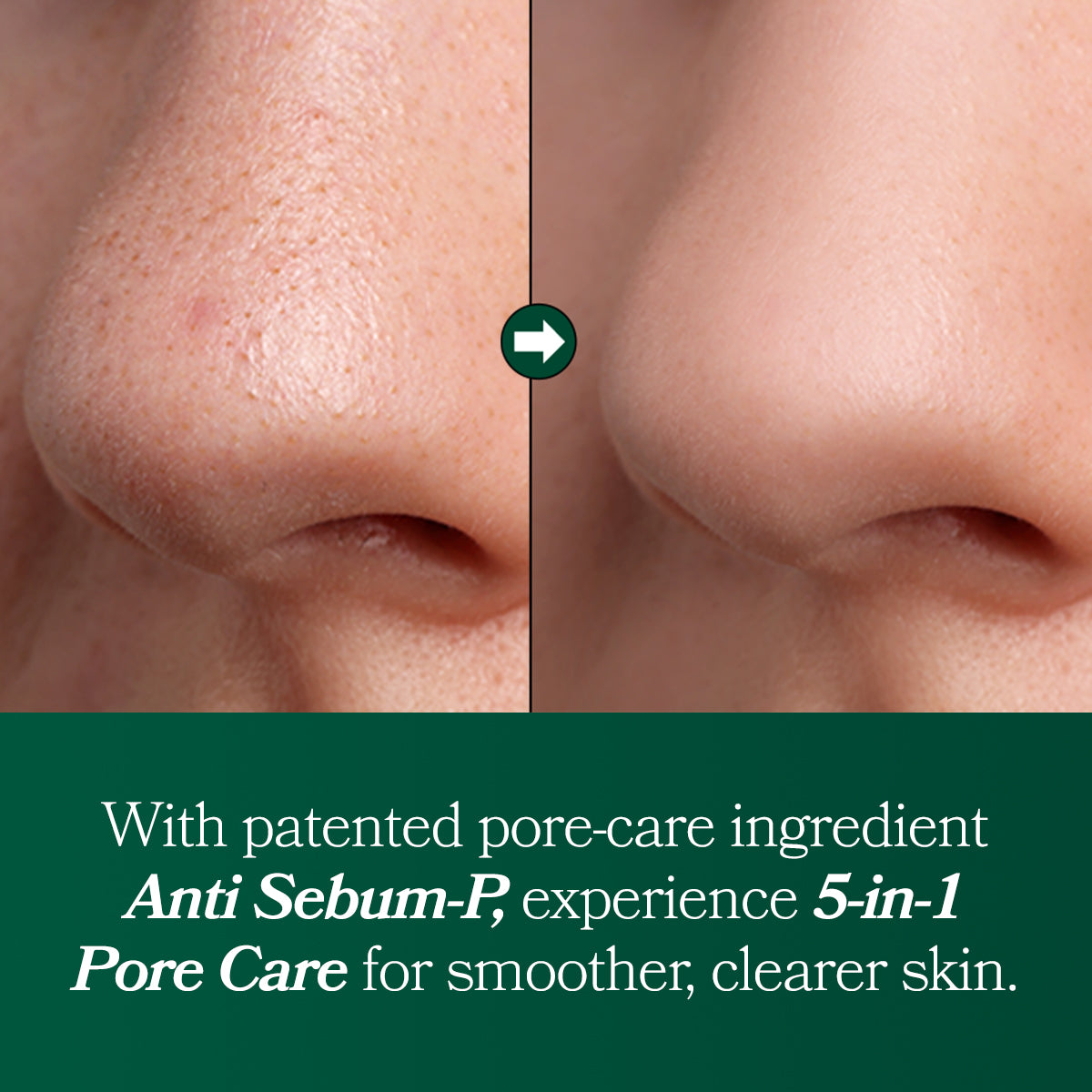 Fresh Lime Glow & Pore Refining Serum 50ml