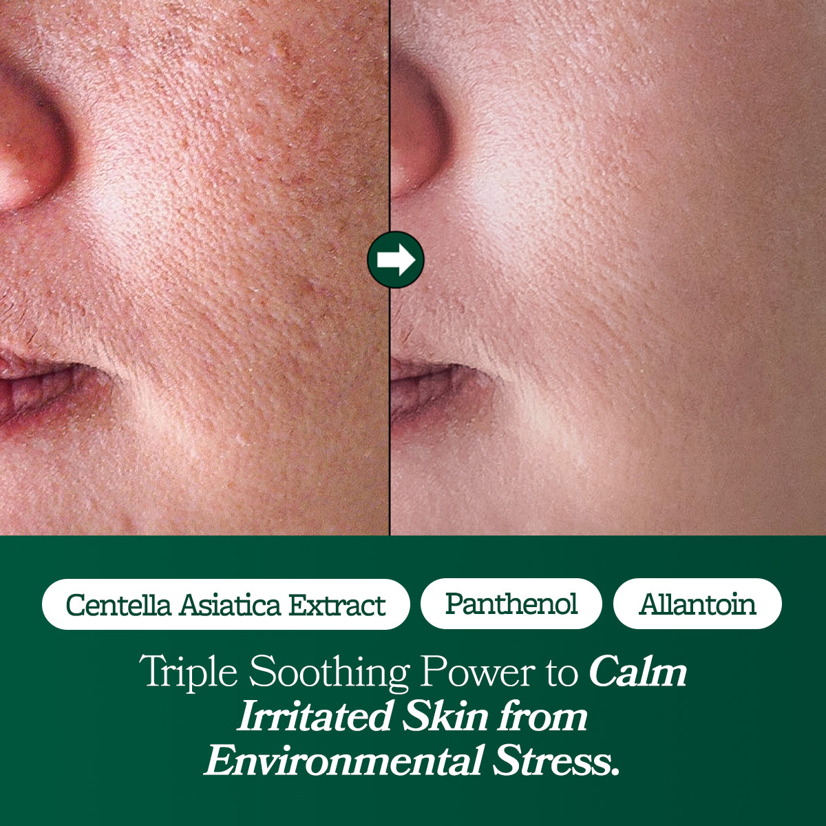 Fresh Lime Glow & Super Hydrating Moisturizer 80ml