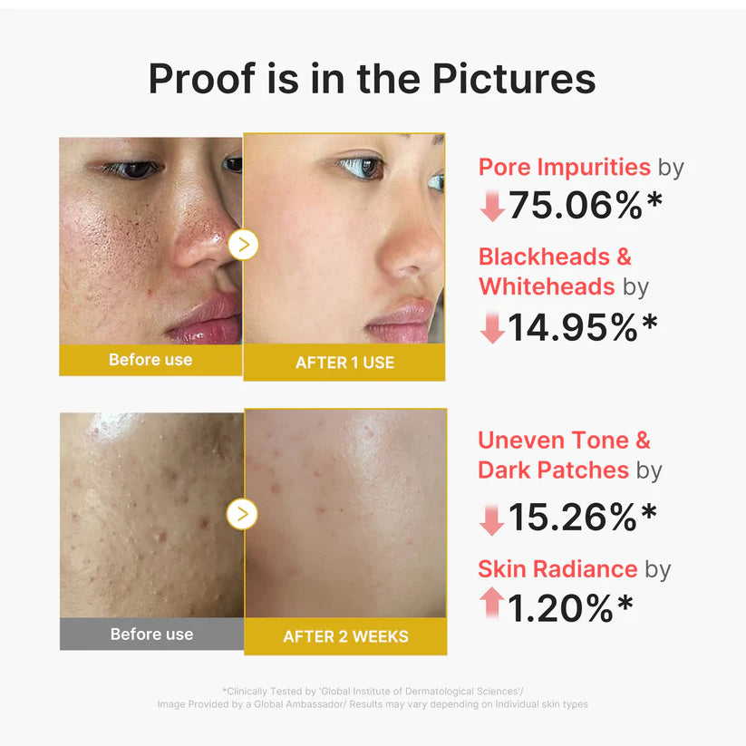Kojic Acid Turmeric Peel Shot 80ml