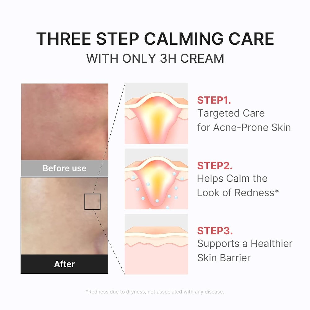 Hypochlorous 3H Relief Cream 50ml