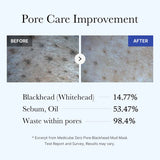 [Medicube] Zero Pore Blackhead Mud Mask 100ml